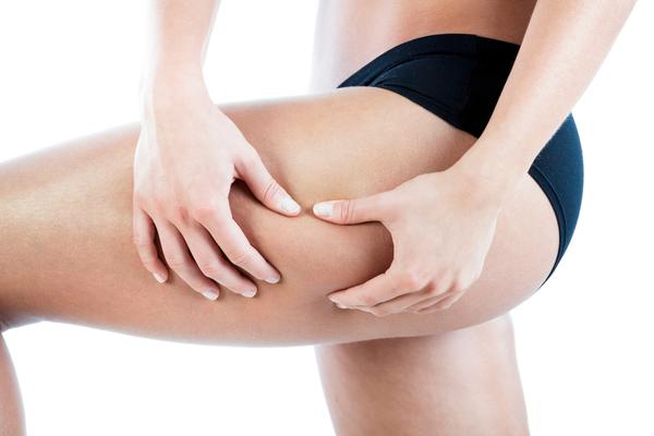 Which Cellulite Treatment is Most Effective?