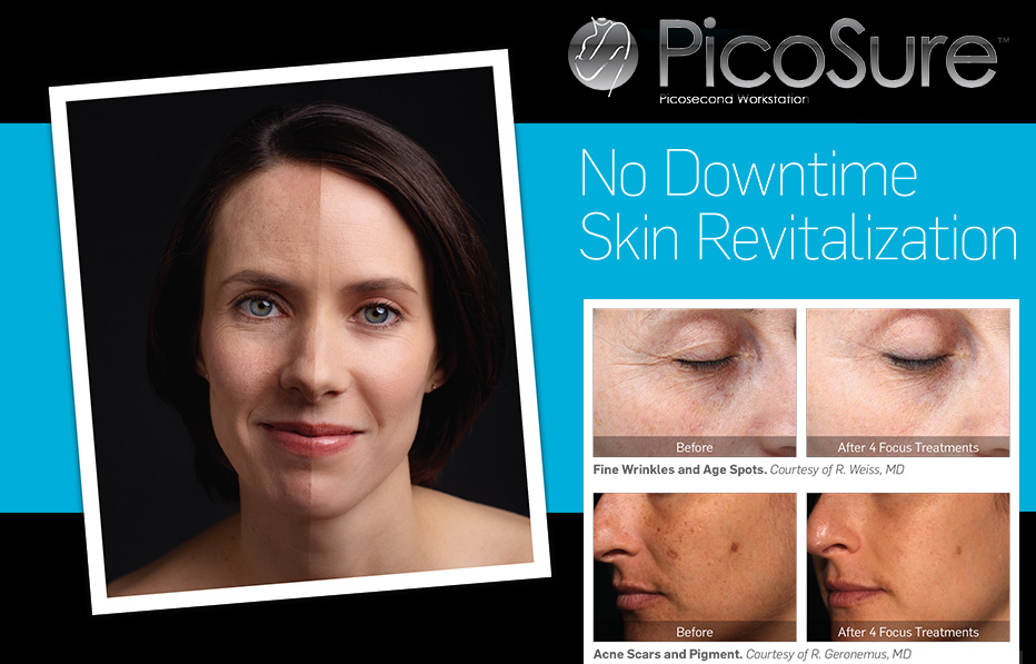 PicoSure Laser Skin Revitalization: Reverse Aging Breakthrough