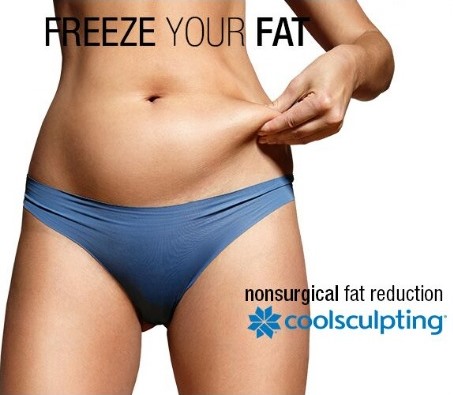 How Long does CoolSculpting Last?