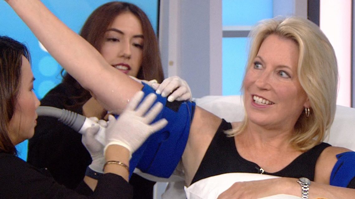 Will Coolsculpting Work on My Arms?