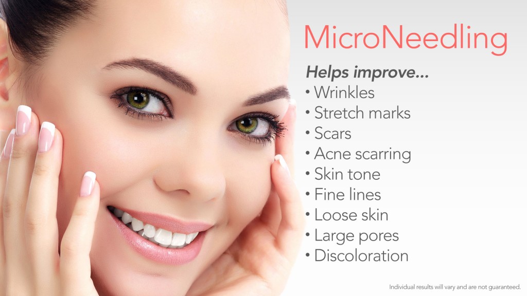 How Exactly Does Microneedling Work?